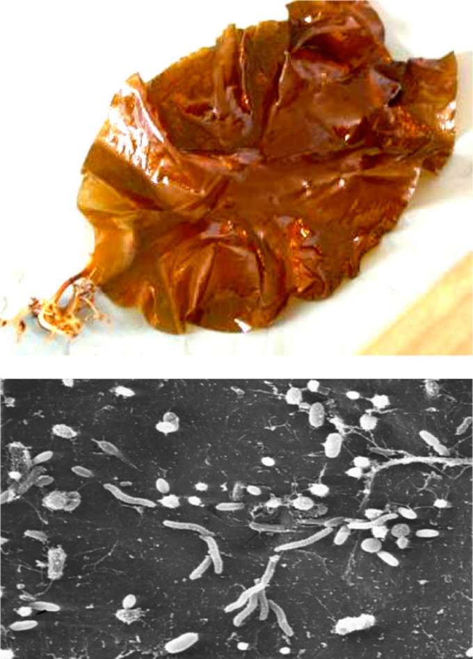 Zuckertang Saccharina latissima Zuckertang mit Aufnahme Mikroskop