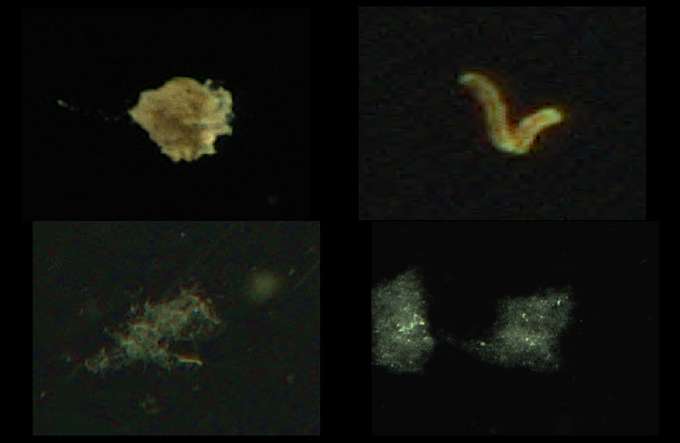 Beispielbilder von unterschiedlichen Marine snow Aggregaten aufgenommen mit einer Unterwasserkamera  Plankton